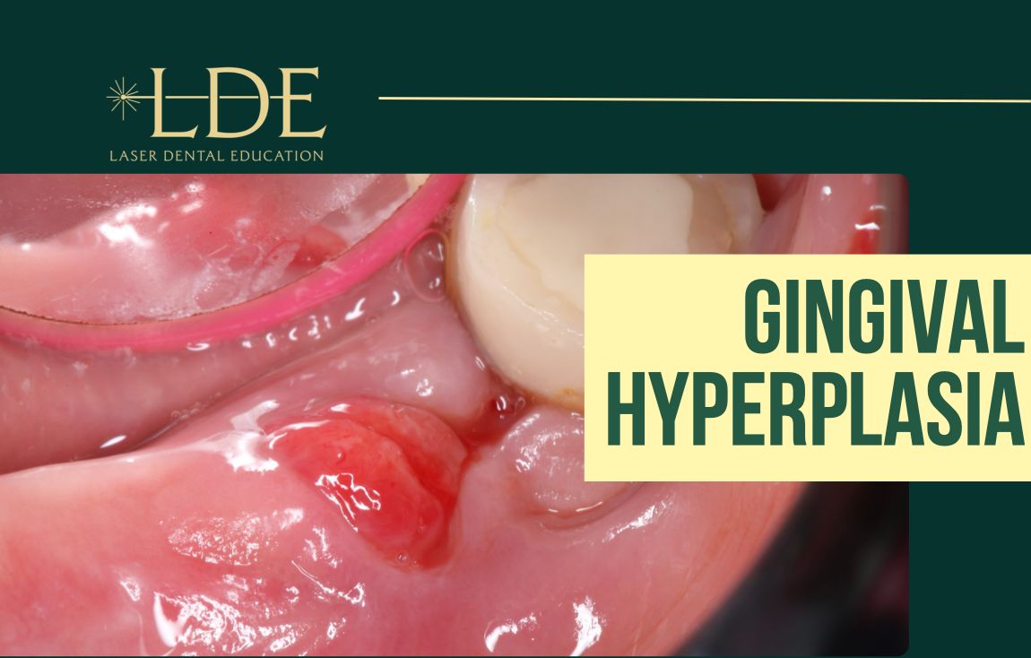Gingival